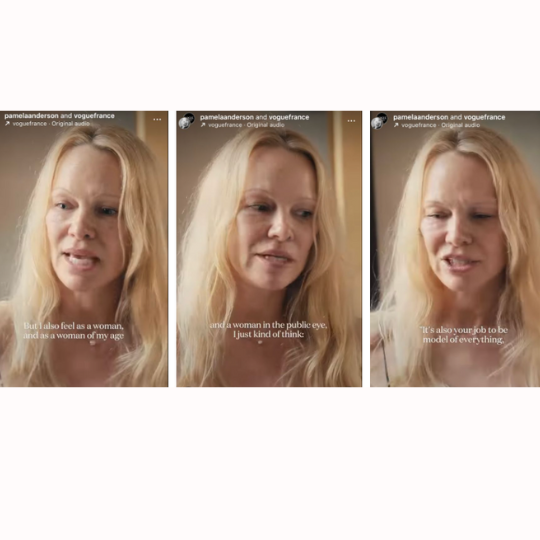 Pamela Anderson: What Her Story Says About Us By Daisy Foster