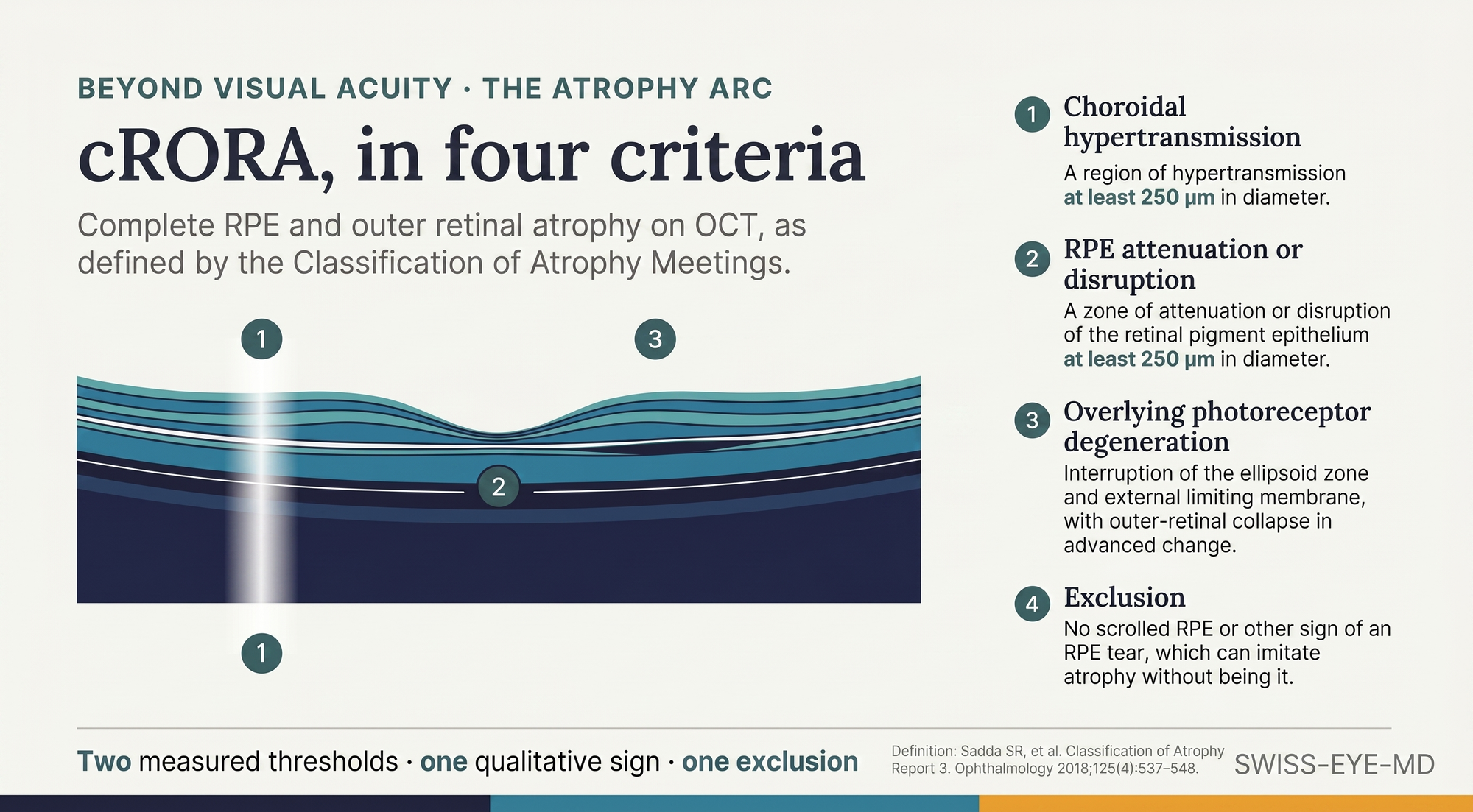 Infographic summarising the four cRORA criteria: hypertransmission of at least 250 μm, RPE attenuation or disruption of at least 250 μm, overlying photoreceptor degeneration, and exclusion of an RPE tear