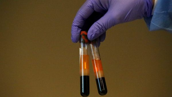 Same blood test, different results: Why isn’t this common thyroid screening reliable?