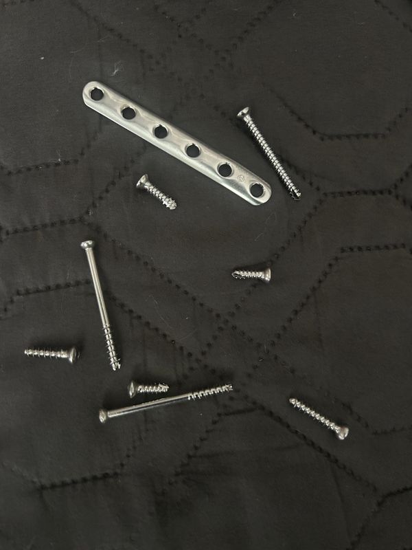 The Metal Inside