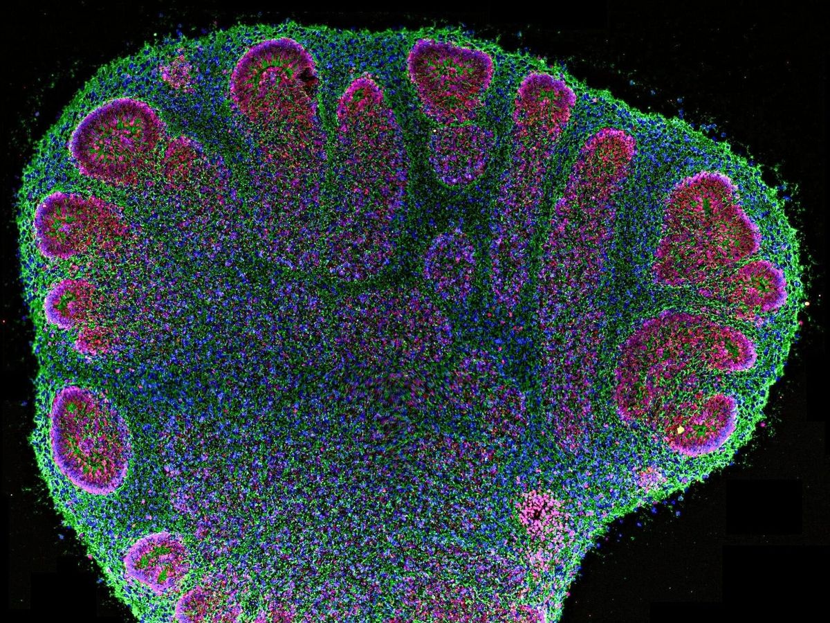 Computers Made of Human Brain Tissue Identify Braille Letters In Breakthrough