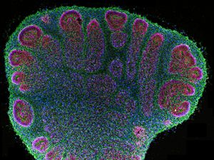 Computers Made of Human Brain Tissue Identify Braille Letters In Breakthrough