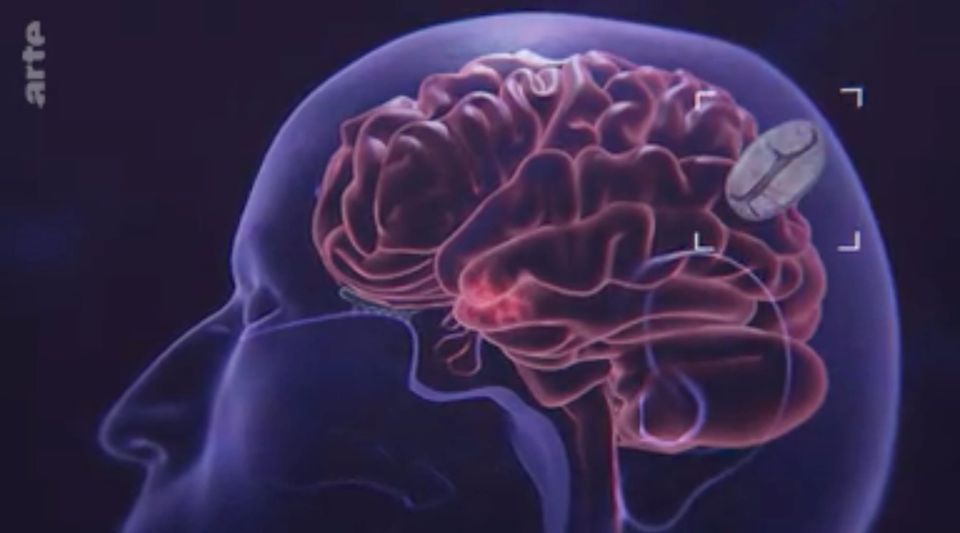 _277_ Durch die Nase