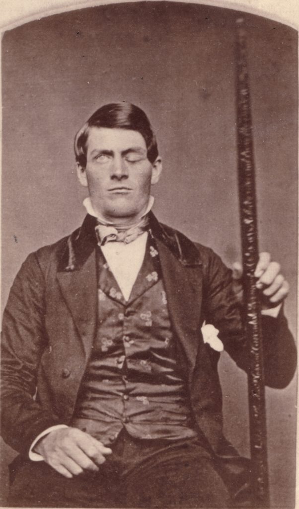 Phineas Gage Emotional Intelligence