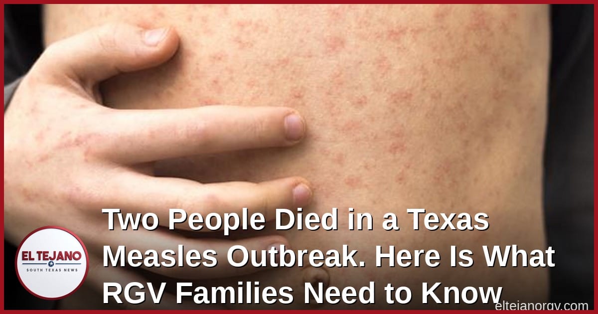Two People Died in a Texas Measles Outbreak. Here Is What RGV Families Need to Know.