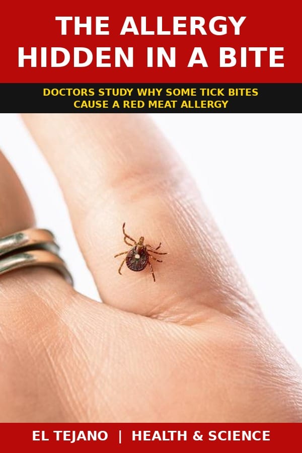 Doctors Now Ask Why Some Tick Bites Turn Into a Meat Allergy