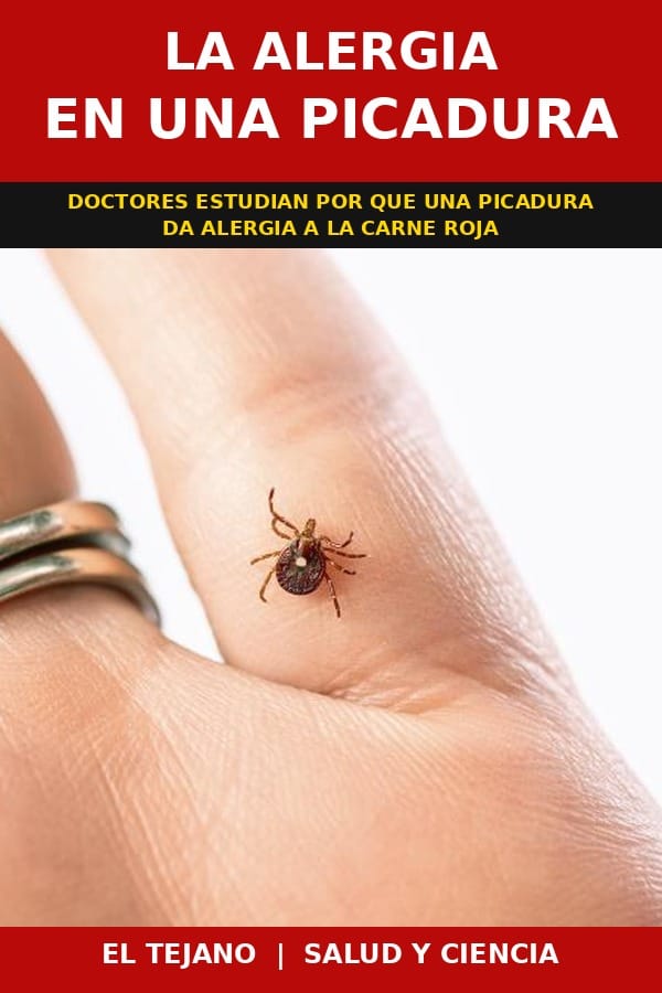 Una Garrapata Le Dio Alergia a la Carne. Ahora los Doctores Quieren Saber Por Que