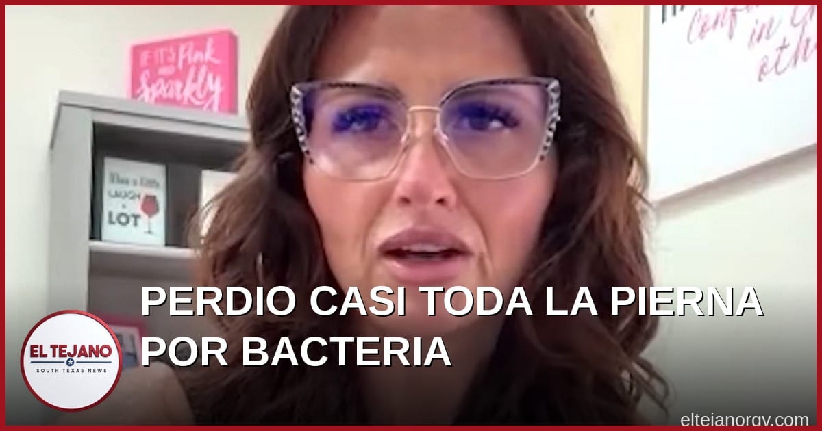 Mama de la Florida Perdio Casi Toda la Pierna por una Bacteria. Esta Es Su Advertencia