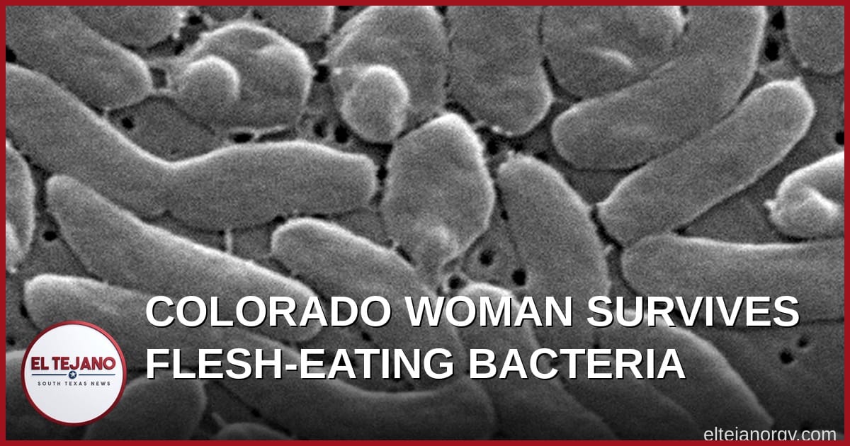 Colorado Woman Shares Story of Surviving Flesh-Eating Bacteria