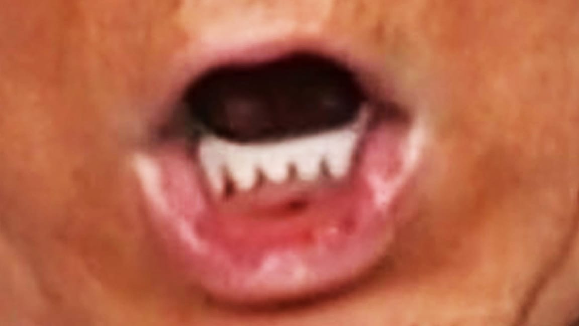 Donald Trump's mouth hole.
