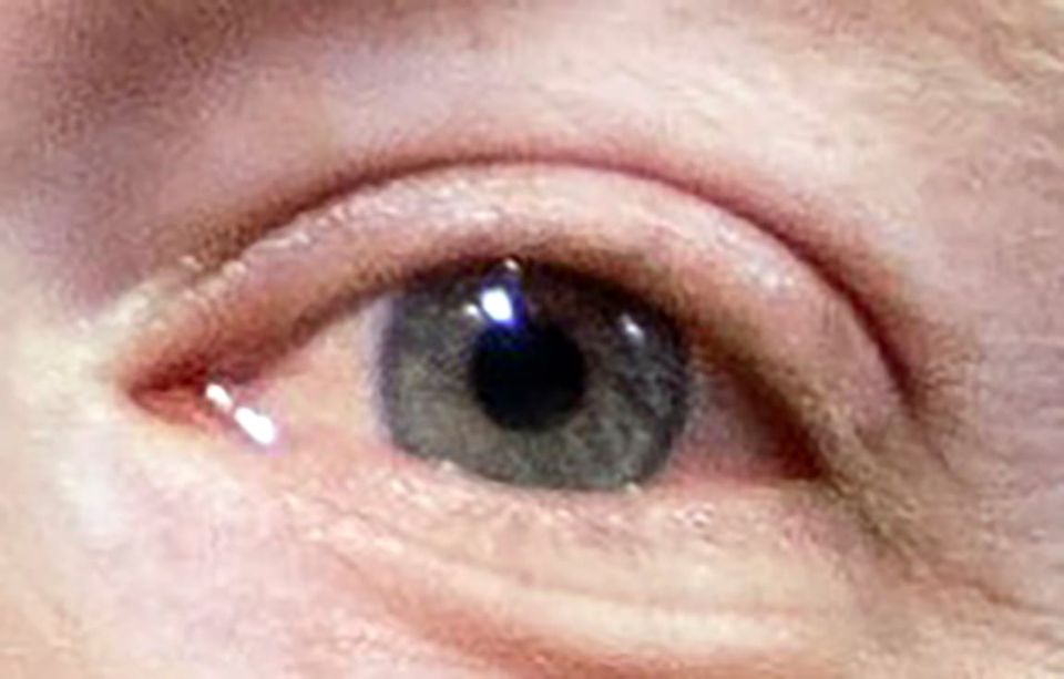 The eye of Zuckerberg
