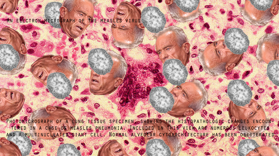 A bunch of floating RFK Jr. heads swimming in a photomicrograph along with electron micrograph images of measles virus. 