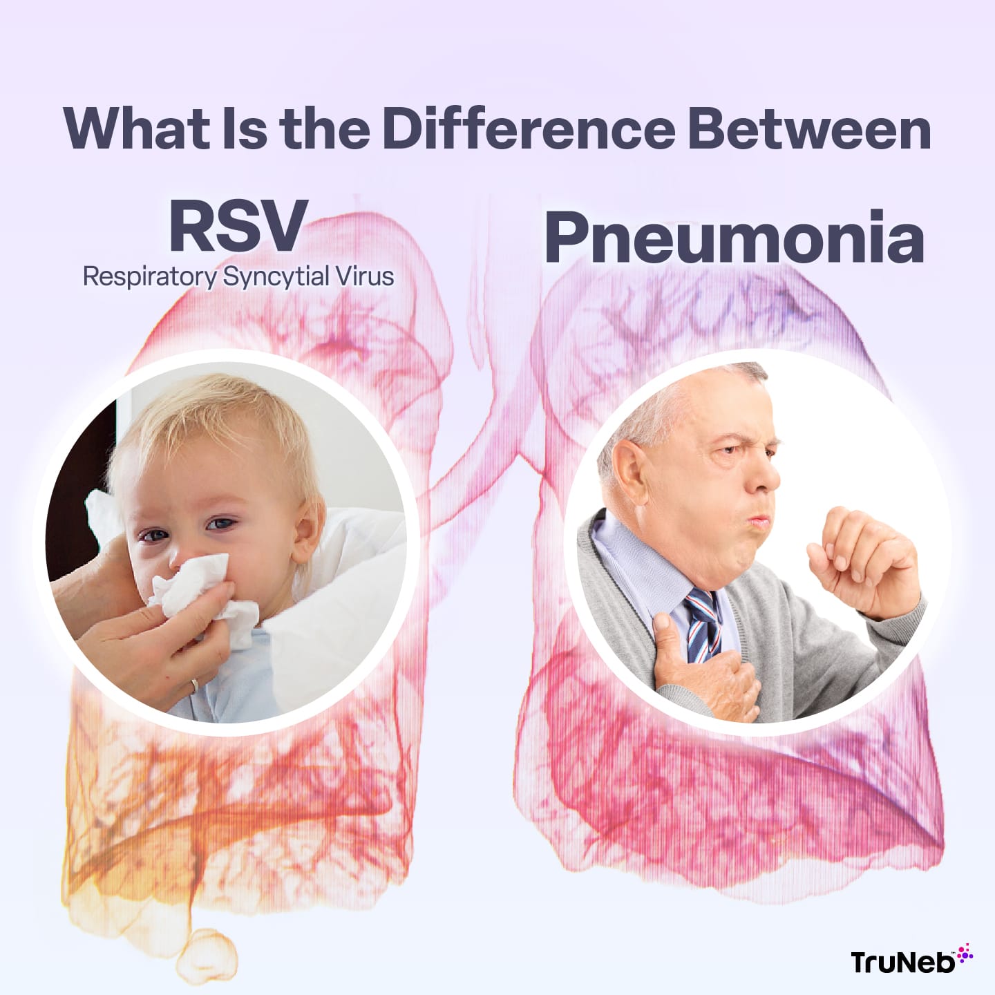 Difference Between RSV and Pneumonia