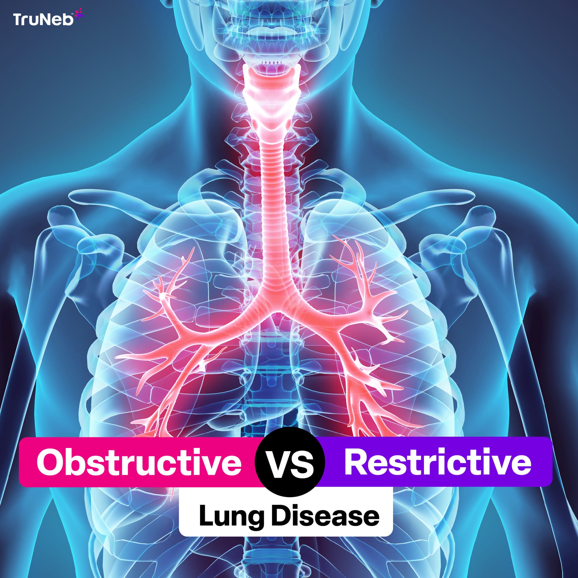 Obstructive lung disease vs Restrictive lung disease