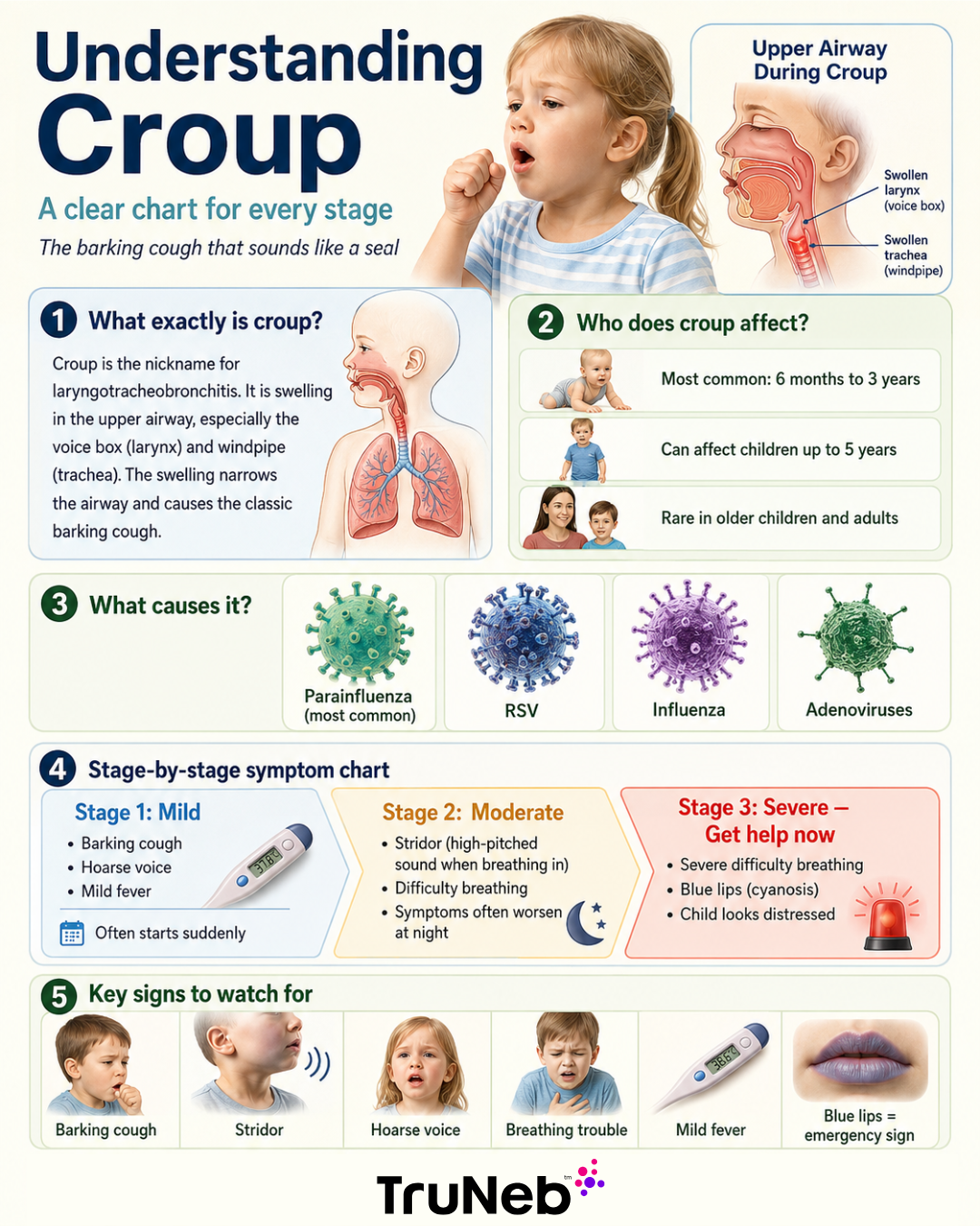 Infographic to Understand Croup