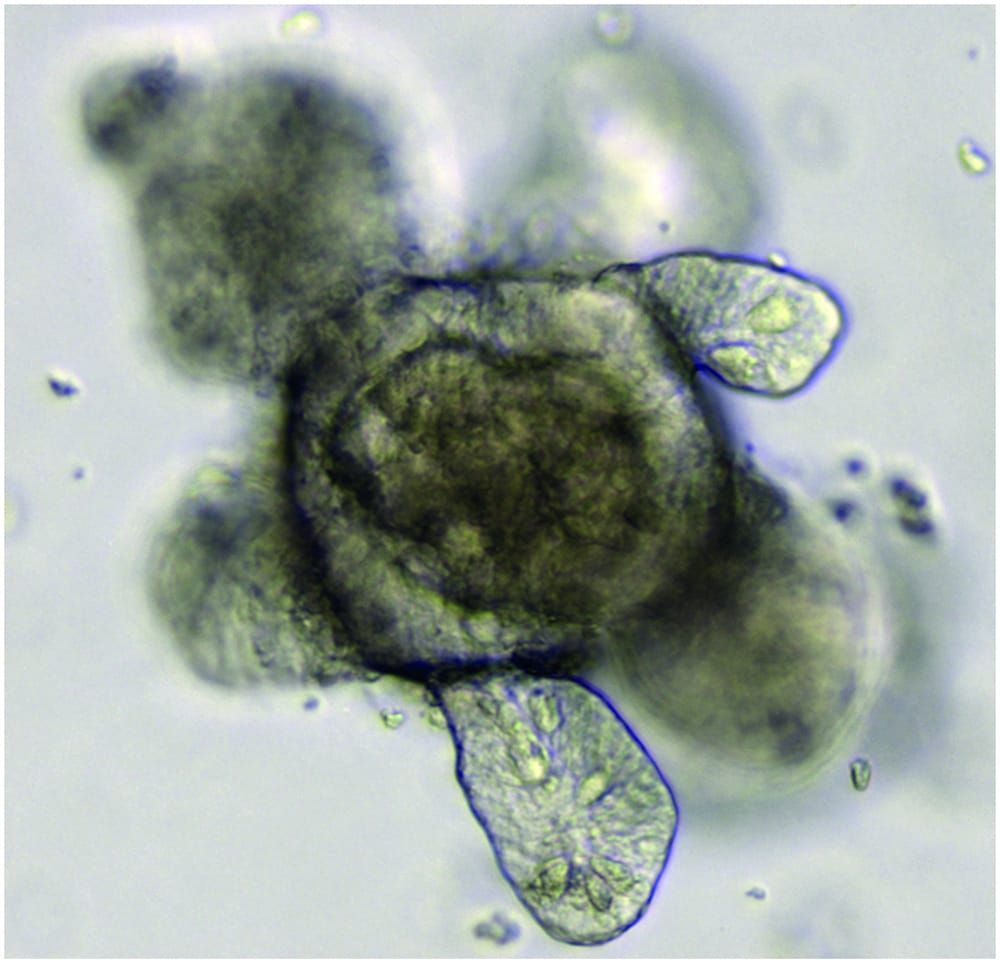 Organoids are Nature’s method of the year