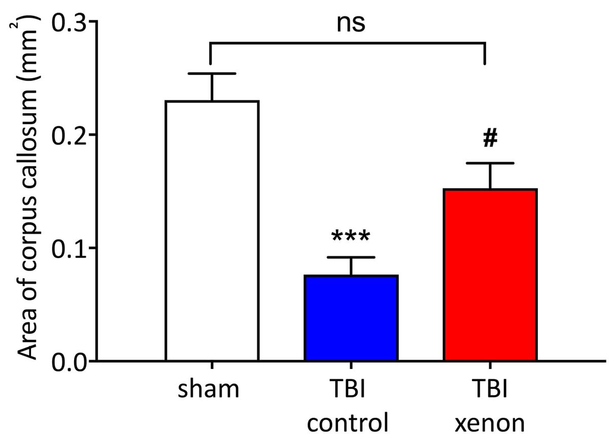 Xenon could be used to reduce traumatic brain damage, Imperial study finds