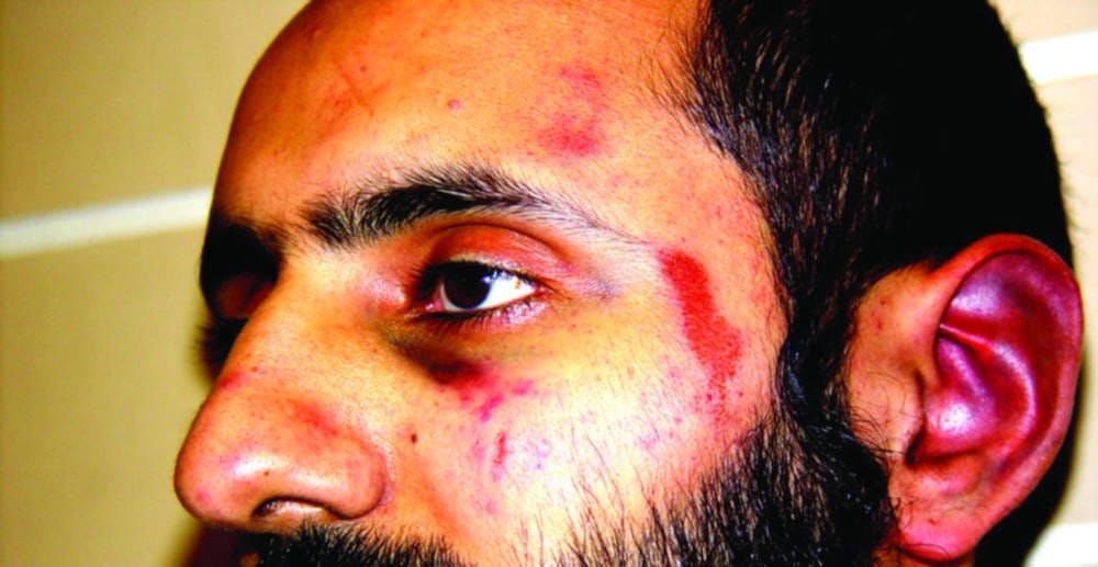 All four officers acquitted in Babar Ahmad assault trial