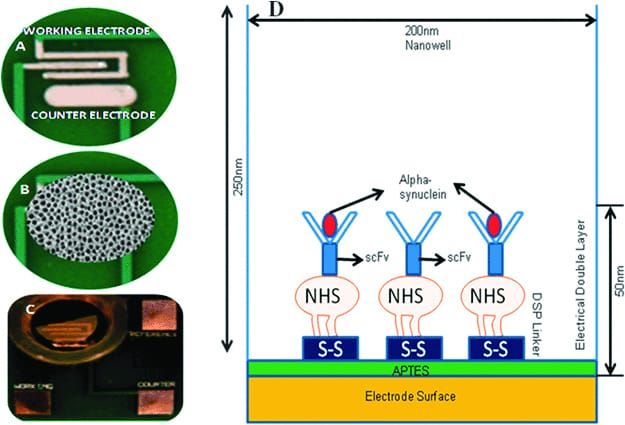 New milestones reached in fight against Alzheimer’s