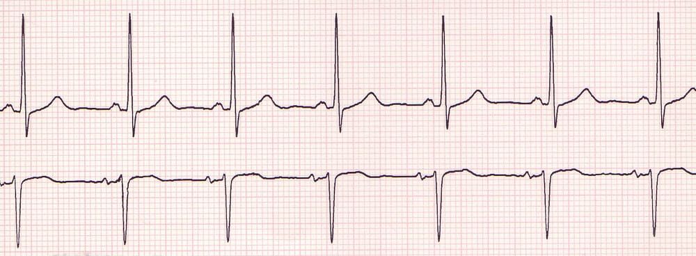 Rhythm is the Ritalin