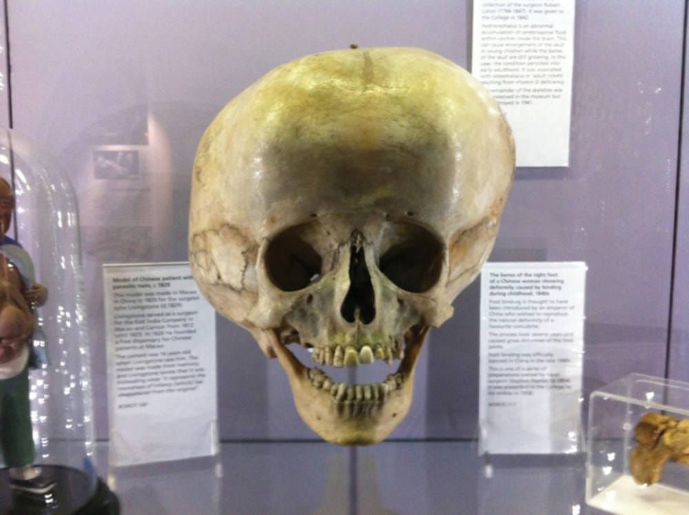 Creepy and Curious at the Hunterian Museum
