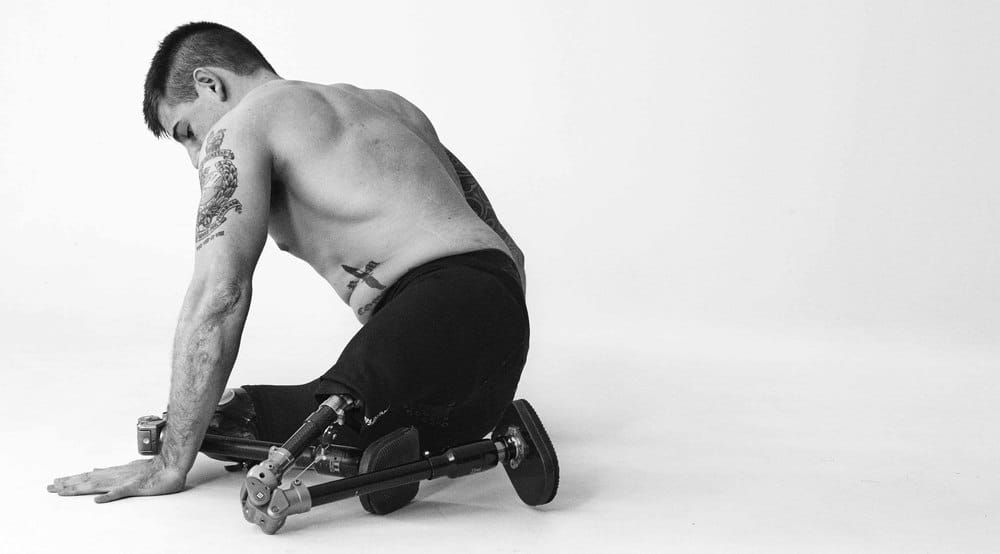 Wounded: Is This War’s True Legacy?