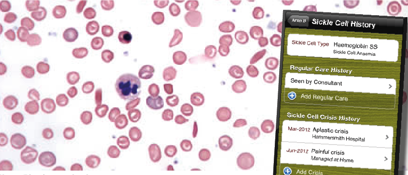 Phone app designed to aid sickle cell anaemia management