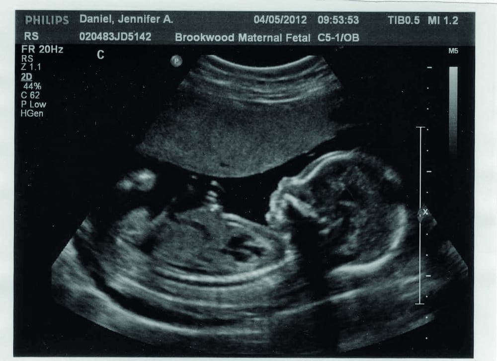 Facing difficult decisions in medicine