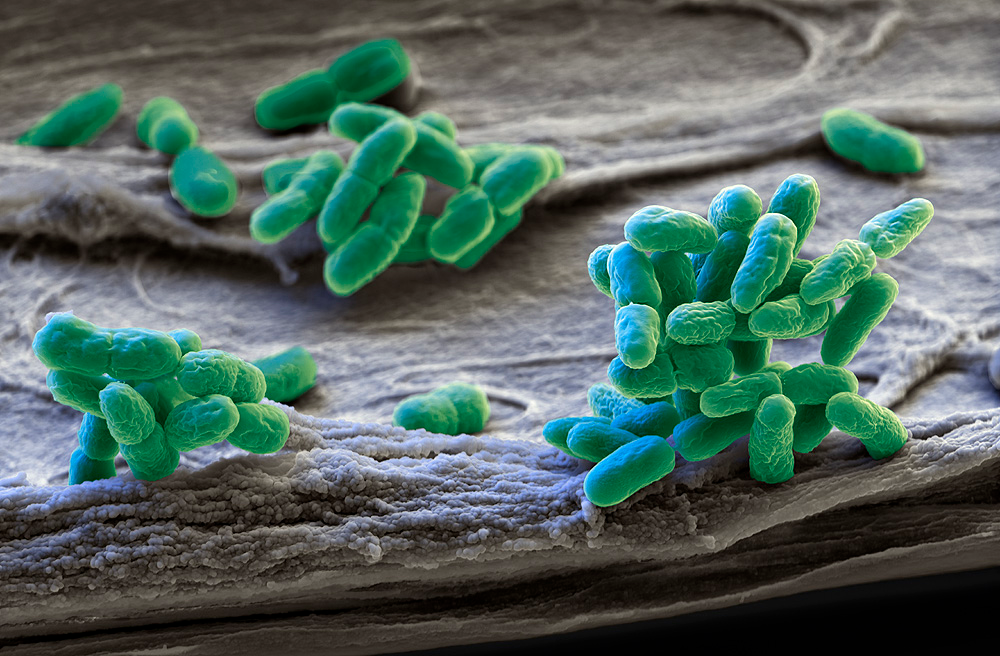 A fresh look through bacteria
