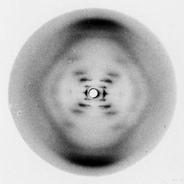Watson is gone. It’s time to remember Rosalind Franklin.