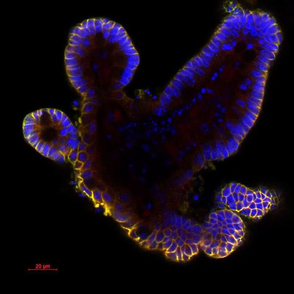 Imperial launches Centre for Intestinal Systems