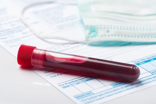 RNA markers in blood predict disease progression