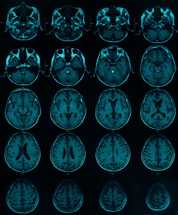 This Week In Science: what if we could experiment on live human brains?