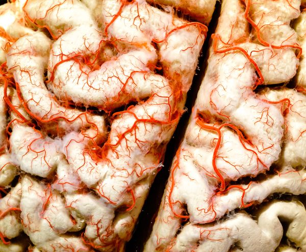 Gut bugs & the brain