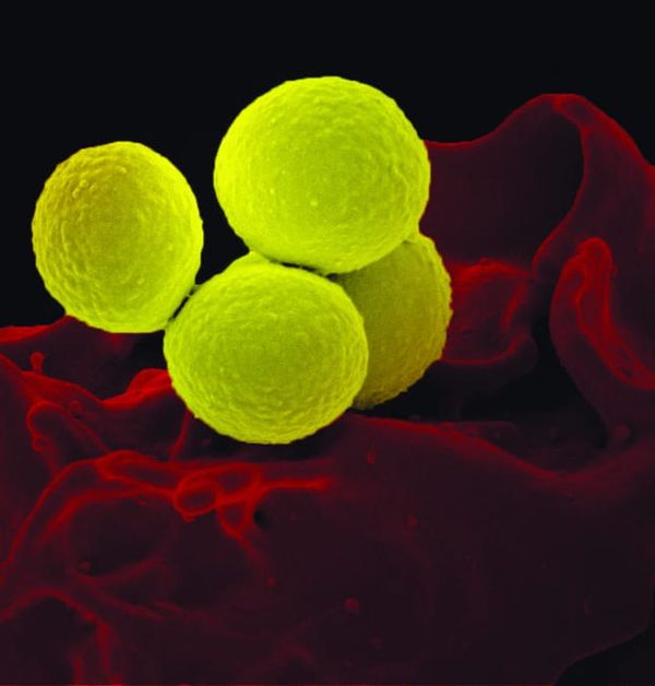 New Antibiotic Resistance Tracking Project Announced