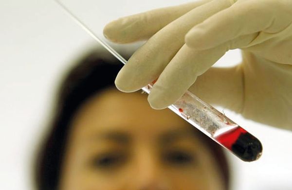 Young blood rejuvenation