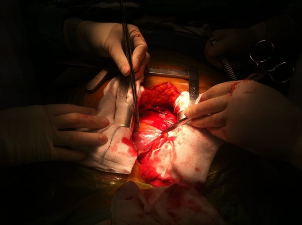 A novel tool for the future of heart repair