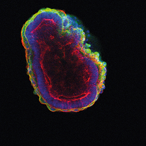 From skin cells to stem cells?