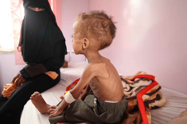 Yemen: an unseen issue