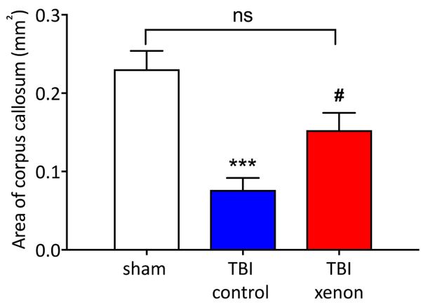 Xenon could be used to reduce traumatic brain damage, Imperial study finds