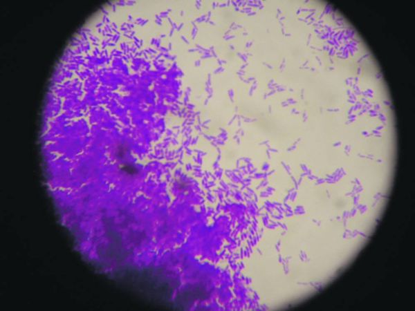 Students with ‘Parasight’