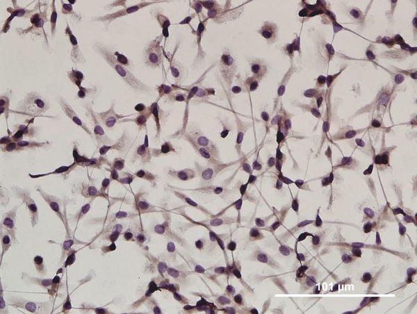 New gene heralds inflammation cures