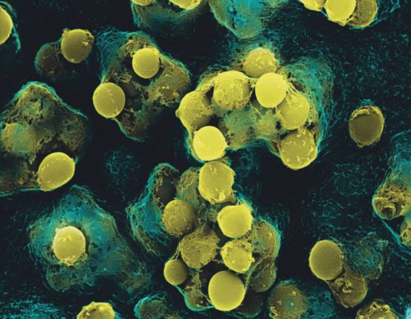 Drug-resistant bacteria mapped