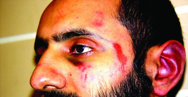 All four officers acquitted in Babar Ahmad assault trial