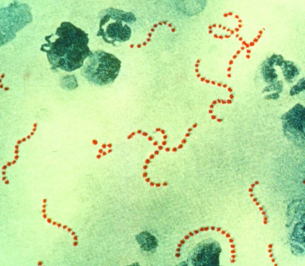 Stuck like superglue