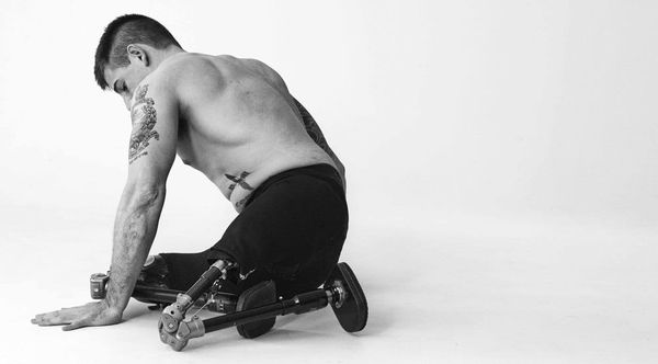 Wounded: Is This War’s True Legacy?