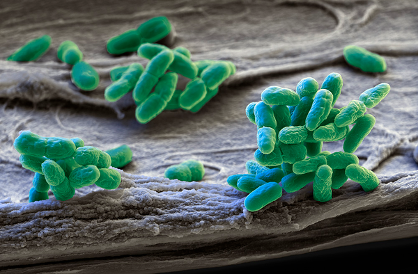 A fresh look through bacteria