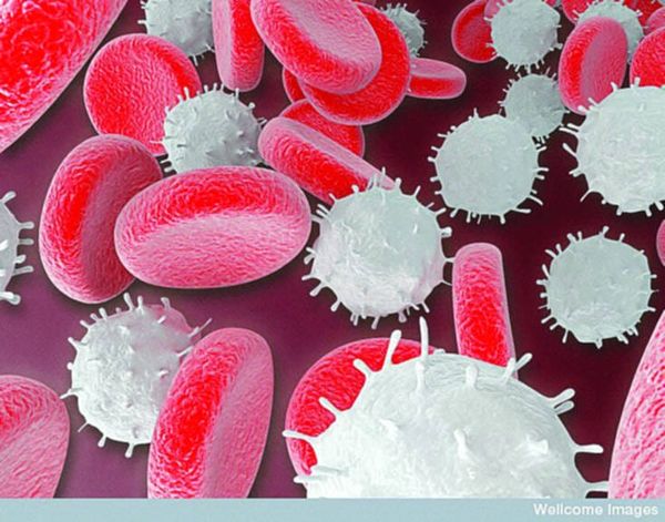 The race to understand leukaemia cells