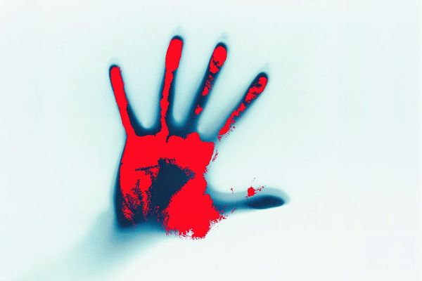 Wounds heal with (a lot of) time