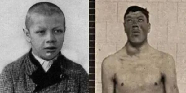 دیو بن جانے والا بونا